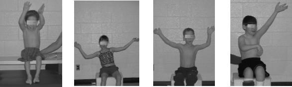 19 Çocuk otururken kolunu, omuzda öne doğru fleksiyon, abdüksiyon ve eksternal rotasyon, dirsekte ekstansiyon, ön kolda supinasyon ve el bileğinde ekstansiyon olacak şekilde hareket ettirin.