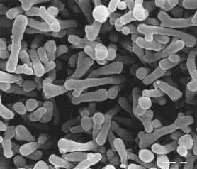 11 Şekil 2.1. Bifidobacterium sp. bakterisinin taramalı elektron mikroskobu görüntüsü. (Istituto di Microbiologia, Piacenza University, Italy) 2.2.3.