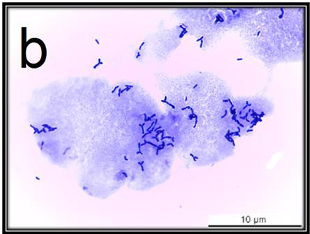 61 Şekil 4.1. Çalışmada kullanılan bazı bakterilerin ışık mikroskobundaki görüntüleri. (a) Lactobacillus fermentum LB69. (b) Bifidobacterium breve BASO1. 4.2.