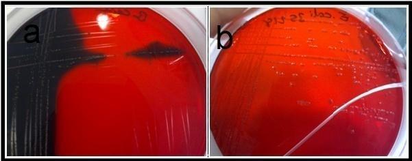 68 göre, siyah renk oluşturan bakteriler güçlü (+++), kırmızı renk oluşturanlar zayıf (+), hem kırmızı hem de siyah renk oluşturanlar ise orta derecede biyofilm pozitif (++) olarak