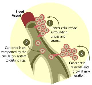 Kontrolsuz bölünen hücreler kan dolaşımı ile diğer