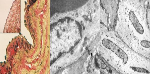 Resim 1. Kontrol grubunda Van Gieson boyamasında normal yapıdaki endotel hücreleri (E). Subendotel katmanın (S) oldukça dar olduğu ayırt ediliyor.