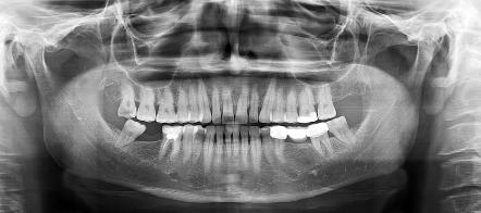 14 Voxel) 3D endodontik tedavi,kök kanal analizi TMJ 3D TMJ Sinus 3D Sinus Mouse kullanmadan, sandalyeden dokunmatik monitör ile yönetebilme Hastane ortamı ve tanılama için DICOM 3.