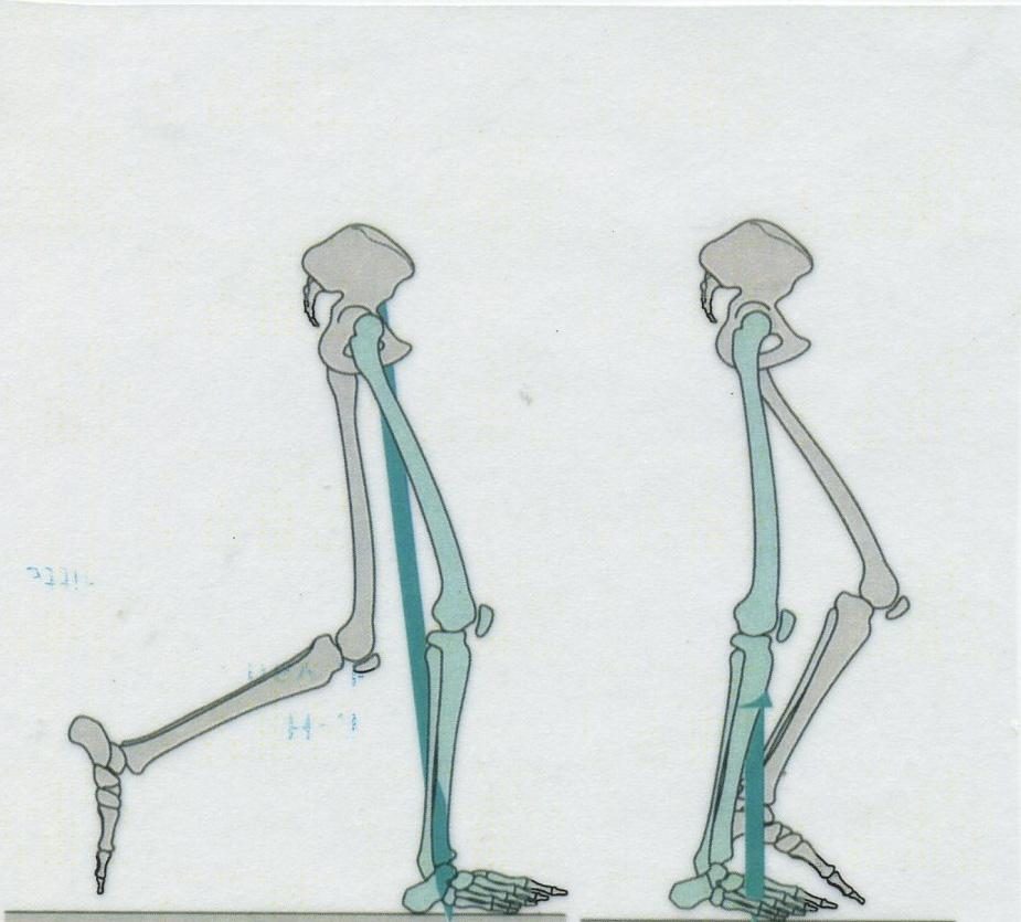 Bu esnada tibialis anterior kontraksiyonu triceps surae kontraksiyonu ile yer değiştirir. Her iki ayak pronasyondadır. Karşı ekstremite internal tibial torsiyondadır.