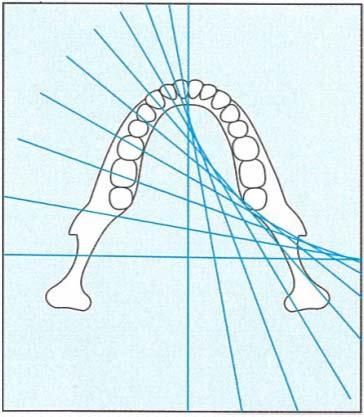 CİHAZIN MEKANİK ÜSTÜNLÜKLERİ C Kolu ile ilgili Özellikler X-ray Sensor Guide Groove (rehber oluk) Dental Arch (dental yay) Y Axis Y ekseni C Kol hareketi: Ortoradyal çarpraz oluk sistemi (V şekilli