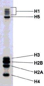 Histon Proteinler Küçük molekül ağırlıklı ve bazik özellikteki