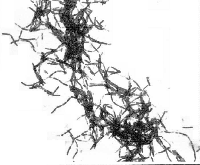 Agar kolonileri 1-2 mm çapında konveks, pürtüklü kenarlı, dalgalı yüzlü, yandan aydınlatıldığında mozaik görüntüsü verirler.