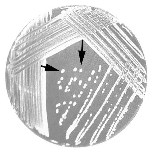 A B C (A) Şekil 16.5. Bir Gram negatif bakteri hücresinin dört farklı büyültmede görüntüsü.