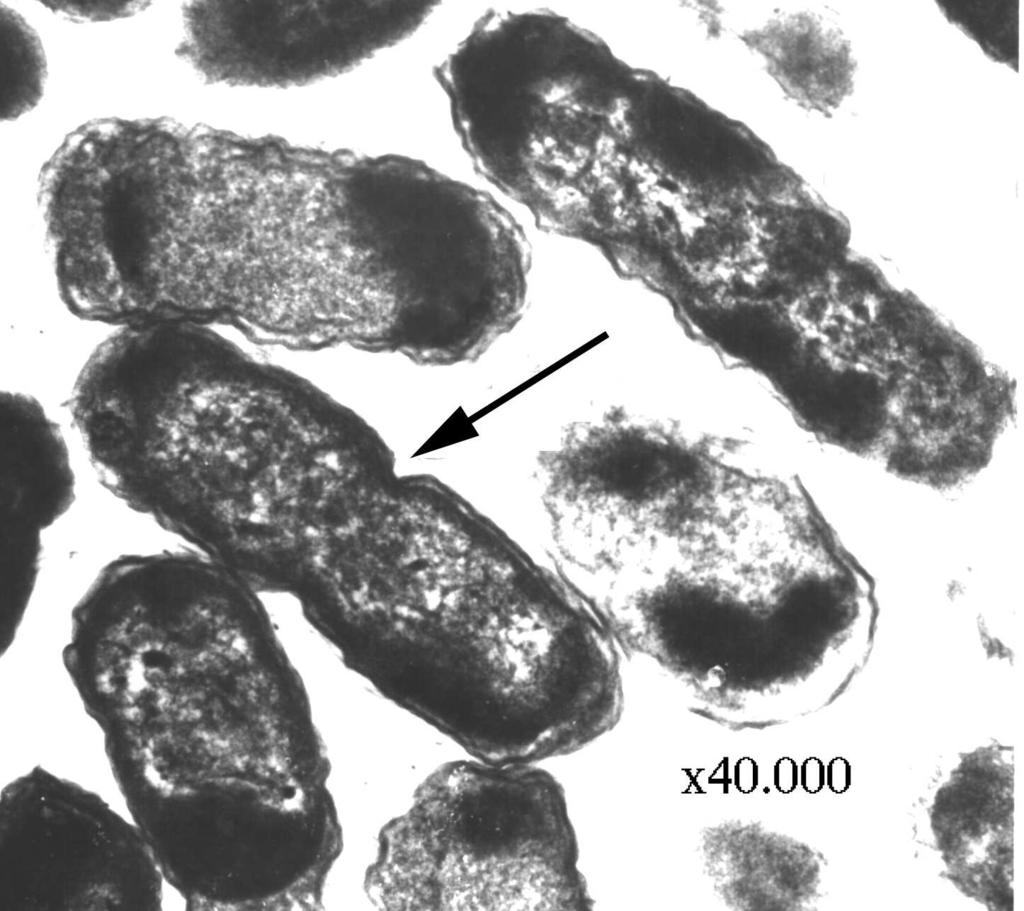 (A) 9 cm çapındaki kültür tabağından 25 cm uzaktan alınan fotoğrafta ok ile işaretlenmiş kolonilerin çapı yaklaşık 1,5 2mm dir, milyarlarca bakteri hücresinin üst