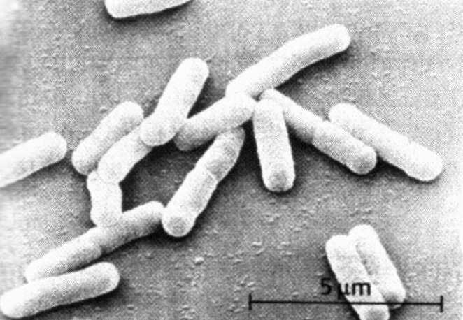 Ok ile işaretlenen hücre bölünmek üzeredir, DNA kutuplara çekilmiştir (Aydın, 1997). (C) Yüzey elektron mikroskopunda Gram negatif çomaklar (Fritz H. Kayzer, 1997).