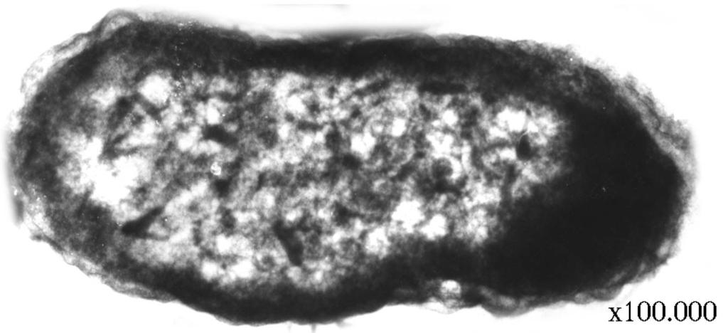 D Bazı bakteriler 8-20 µm uzunluğunda ağaç vidası şeklinde burgu gövdelidir ve kalınlıkları 0,1 µm kadardır.