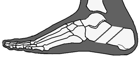 olur. Benzeri şekilde, tibia distal epifizi de anormal kas kuvvetlerinin etkisi ile ayak bileğinde valgusun gelişmesine katkıda bulunur (Şekil 79).