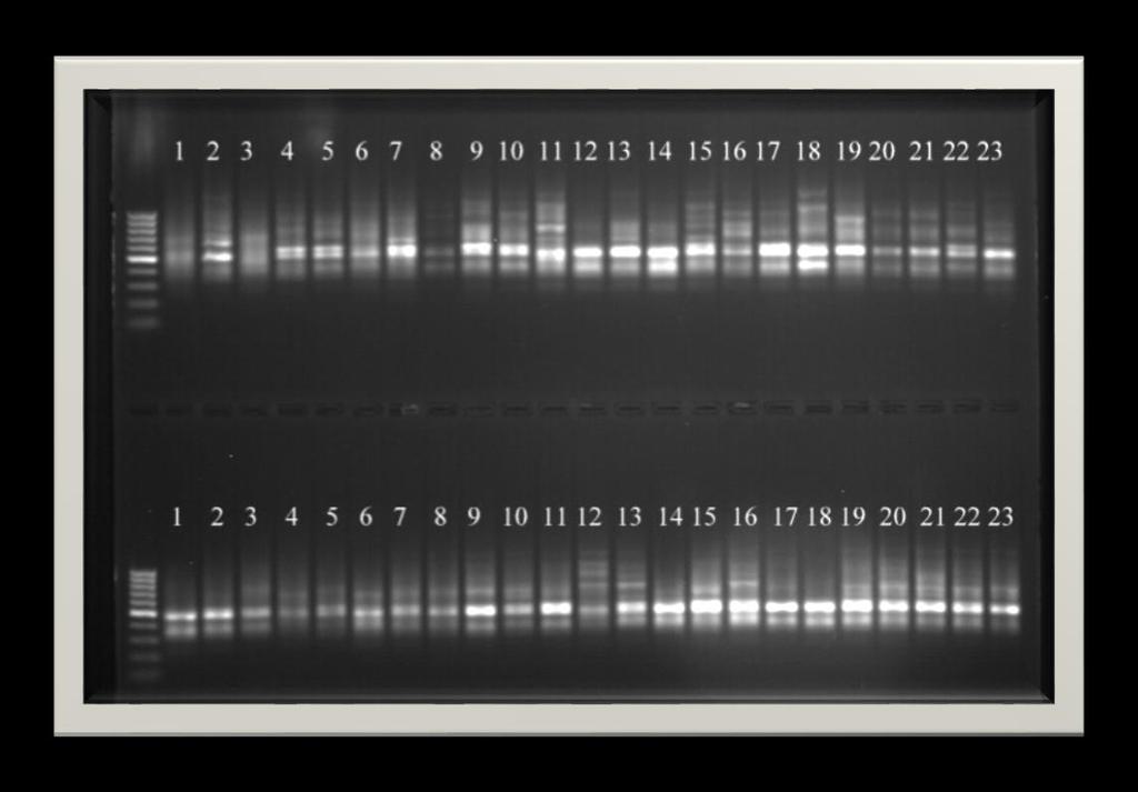 4. ARAŞTIRMA SONUÇLARI VE TARTIŞMA 15 PCR ürünlerinin agaroz jellerde yürütülmesi ile elde edilen görüntüler Şekil 4.1, 4.2, 4.3, 4.4, 4.5, 4.6, 4.7, 4.8, 4.9, 4.10 da verilmiştir.