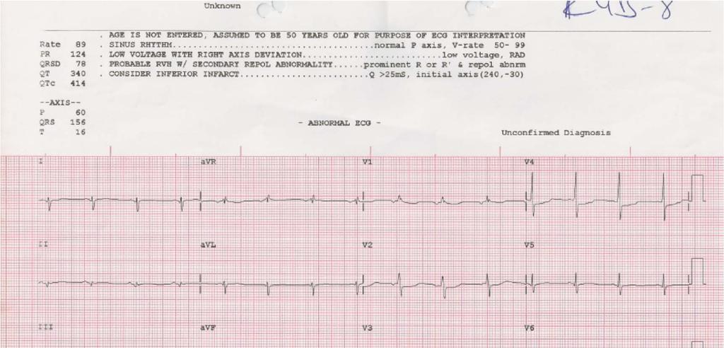 EKG 8.