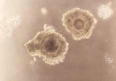 Bo a Spermatozoonlar nda in vitro Kapasitasyon ve Fertilizasyon fiekil 1. Toplanan oositlerde de erlendirilen kumulus oosit kompleksleri (x100). fiekil 2.