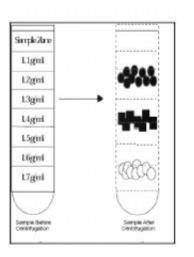 Yoğunluk derecenlemesi santriifüjleme (density gradient ) 1.