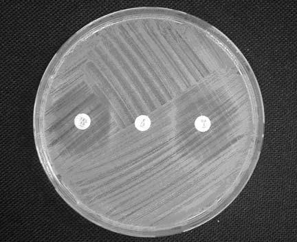 Sarıbaş Z, Tunçkanat F, Özçakır O, Ercis S. S.aureus izolatlarının 4 (%3.6) ünde ve cmls B direnci birlikte (karışık patern) görülmüştür.