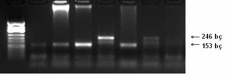 33 2.2.4 Agaroz Jel Elektroforezi ile PCR Ürünlerinin İncelenmesi Agaroz (Applichem, Almanya), EBNA-3C geninin PCR ürünleri için 1,5 g/75 ml (%2) olacak şekilde tartılır.