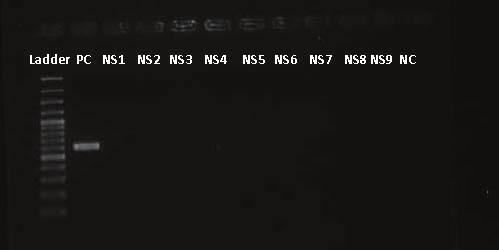 bla OXA5 nin PZR sonrası jel görüntüsü Ladder: Promega bp DNA Ladder Plus; PS 9: Pozitif Suş; NS: Negatif Suş;