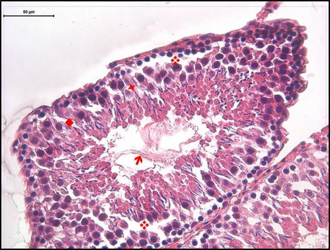 spermatidler ( ), Sertoli hücreleri ( ), interstisyel bağ doku ( ), ve damarlar ( ) ilgiyi çekiyor (Hematoksilen- Eozin x400).