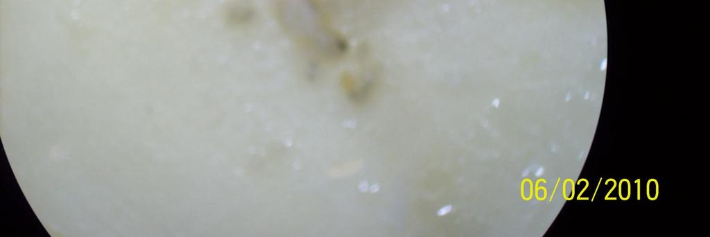 adet düz yüzeyli kaşar peyniri üzerinde oluşan fungus büyüklüğünün çapı 8 kez ölçülmüş ve fungus kolonisinin kaşar peynir yüzeyindeki alanı, daire alan