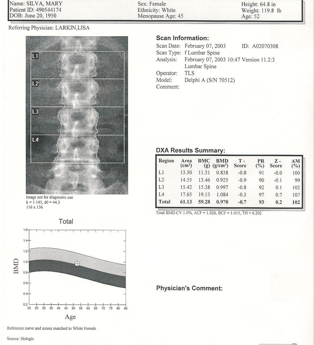 DEXA kemik yoğunluk ölçüm raporu Demografik görüntü Kemik mineral dansitesi T skoru : genç referans popülasyon ile
