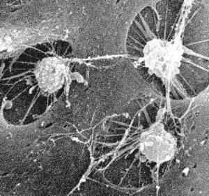 1-Osteoprogenitor hücreler Osteojenik hücreler de denen bu hücreler mezenkim hücrelerinden köken alır Mitozla çoğalırlar ve osteoblastlara dönüşürler Kemik yapımı sırasında aktif ve boldurlar Periost