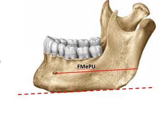 A Resim 2. 3. Foramen mentale nin ramus mandibulae nın arka kenarına uzaklığı.