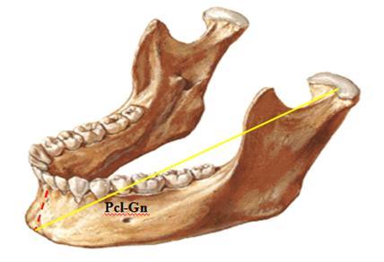 A B Resim 2. 9. Proc. condylaris-gnathion uzunluğu.