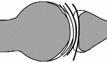 6 Acta Orthop Traumatol Turc Suppl baz araflt rmac lar eklemin tam bir ball-and-socket eklemi (enartroz her yönde hareketli bir eklem) olmas na, baz lar da hafif derecede s n rl (constrained) bir