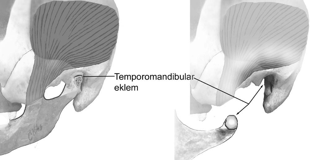 Articulatio temporomandibularis (mandibula eklemi, alt çene kemiği eklemi); articulatio bicondylaris tipi eklemdir. Oynar eklemdir.