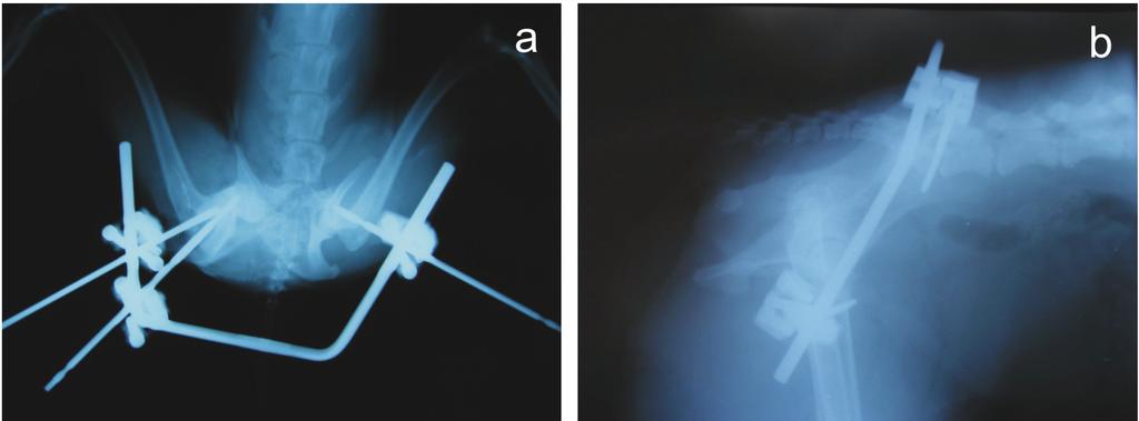 50 Hüseyin Çakıroğlu - Hasan Bilgili Şekil 3. Olgu no: 1 in postoperatif VD (a) ve LL (b) radyografik görüntüleri. Figure 3. Postoperative VD (a) and LL (b) radiographical views of Case no: 1.