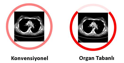 kapatılması prensibine dayanır - Yüzeye yakın organ dozlarını azaltırken, diğer organ dozlarını