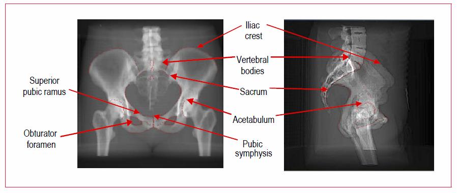 Pelvis Asetabulum, simpfiz ve