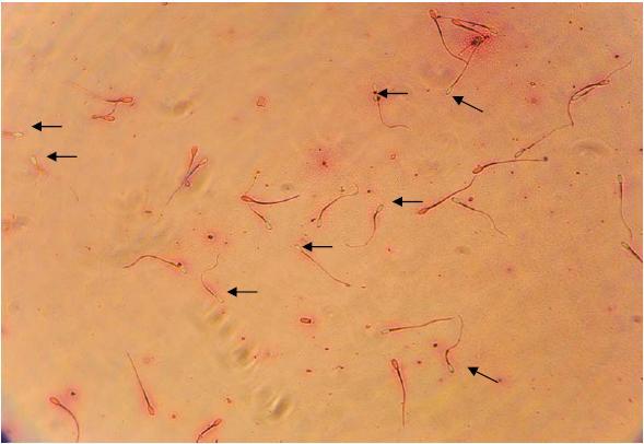 22 Resim 9. Ölü ve canlı spermatozoonlar. Canlı spermatozoonlarlar boya almamakta ve baş kısımları açık renkte görülmektedir. Ölü spermatozoon baş kısmı ise kırmızı boya almakta olduğu görülmektedir.