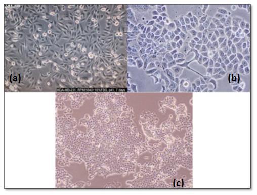 20 ġekil 2.3. Meme kanseri hücre hatlarından bazılarının mikroskopik görüntüsü, [(a)mda-mb-231, (b) MCF-7, (c) T47D] 2.6.