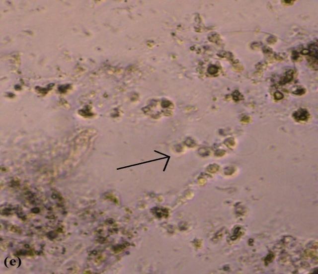 (a) MCF-7/S hücre