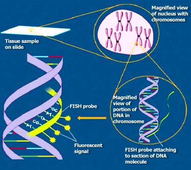 A) Tanısal amaçlı kullanılan FISH 1. Klinik sitogenetik a. Prenatal tanı b. İnterfaz sitogenetiği c. Mikrodelesyon sendromlarının tanısı d. Kanser sitogenetiği 2.
