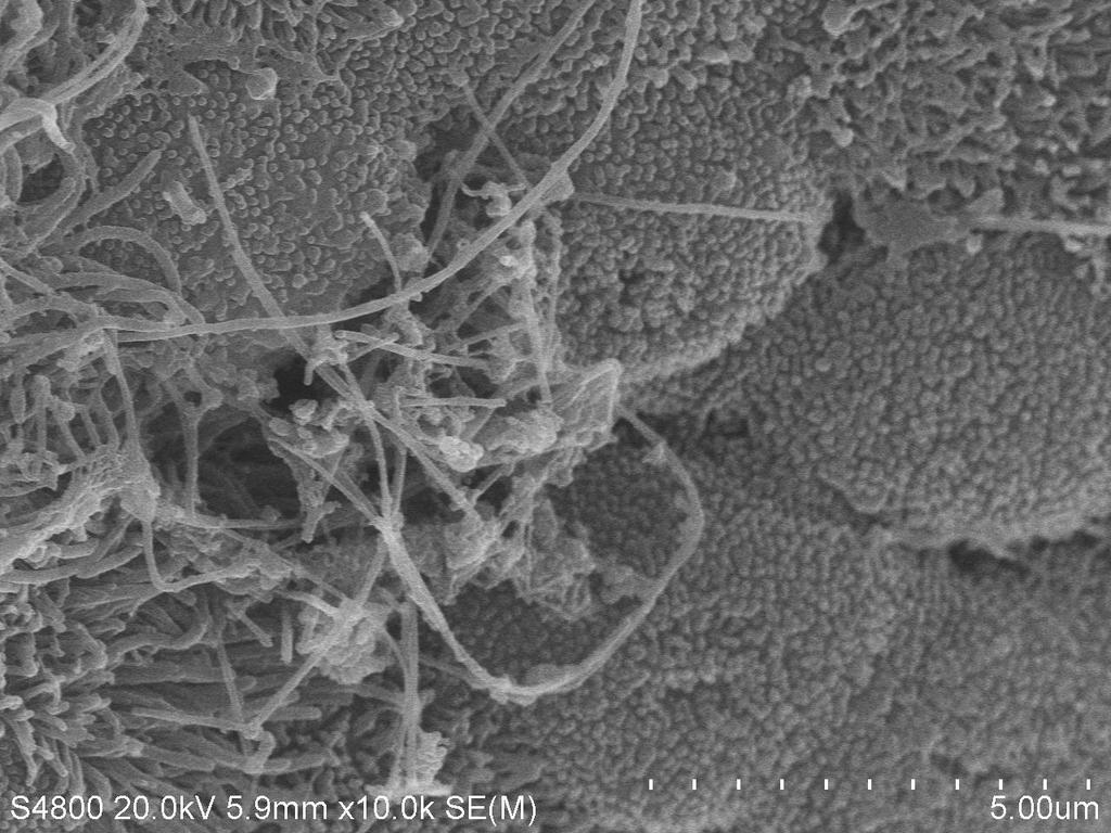 17 İletici Hava Yollarında Çok Duvarlı Karbon Nanotüpler