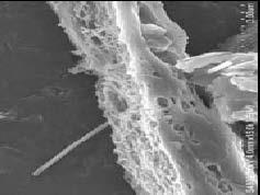 20 Akciğerlerden Çok Duvarlı Karbon Nanotüp (MWCNT)