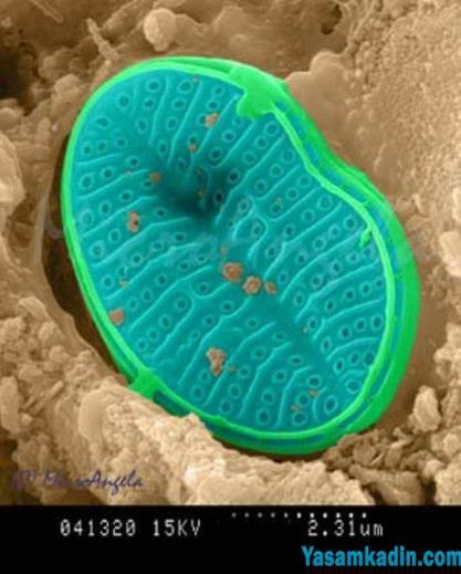 Diatom Nedir? Diatomlar, silisli hücrelere sahip olan mikroskopik büyüklükteki tek hücreli su bitkileridir.