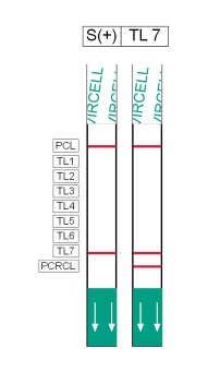 TL4, TL5, TL6) gözlenebilir. Test sadece bir PCR tübünde birçok PCR uygulamasını gerçekleştirir.