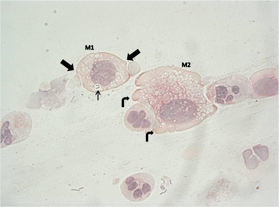 Şekil 4. 6: M1 makrofajının sitoplazmasında vezikül içinde sindirdiği laktobasiller görülmektedir (ok).