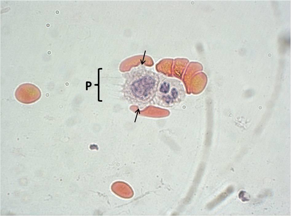Şekil 4. 8: Hücre zarları kaynaşmış bir PMNL ve makrofaj yan yana görülmektedir. Makrofajın zarından eritrositlere doğru uzanmış kısalı uzunlu çok sayıda pseudopod (P) dikkati çekmiştir.