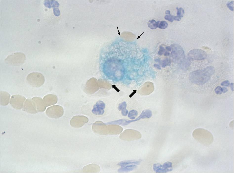 Şekil 4. 17: Sitoplazmasında diffüz boyanma gözlenen bir makrofaj ve çevresindeki eritrositler görülmektedir.