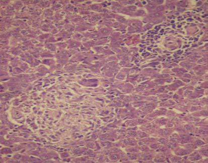 Karaciğerde hafif Kupffer hücre proliferasyonu (H.E.