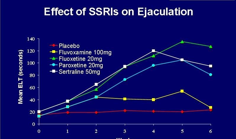 SSRİ Waldinger et al, J Clin