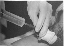 Sistografi Mesane yaralanmaları için klasik olarak kullanılan yöntem.