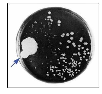 Antibiyotiklerin Geliştirilmesi ertapenem tigecyclin daptomicin