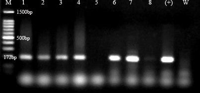 49 Şekil 4.9. PDV için uygulanmış olan RT-PCR testi